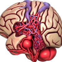Malformações Arteriovenosas Cerebrais e Medulares